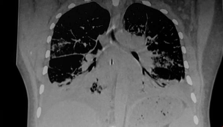 諾丁漢大學新研究中心將促進肺病疾病治療.png 諾丁漢大學新研究中心將促進肺病疾病治療.png