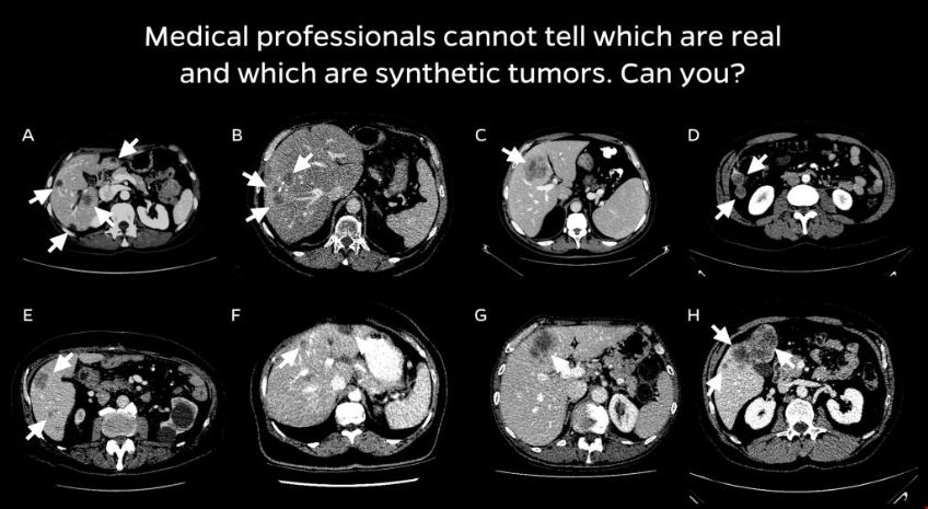 jhu研究員利用人工智能檢測早期癌癥.png jhu研究員利用人工智能檢測早期癌癥.png